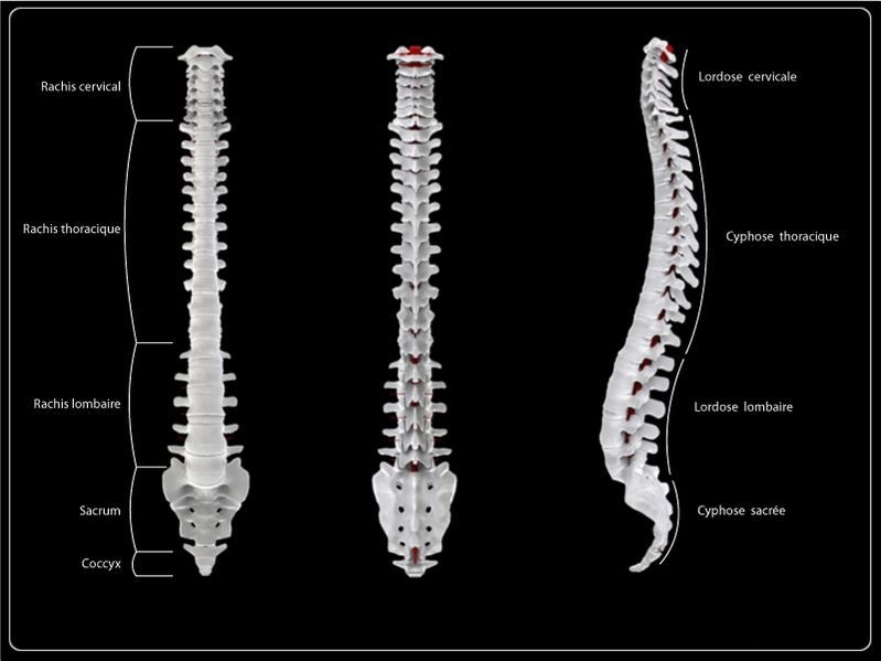 Hernia disco columna vertebral inst. ozonoterapia médica